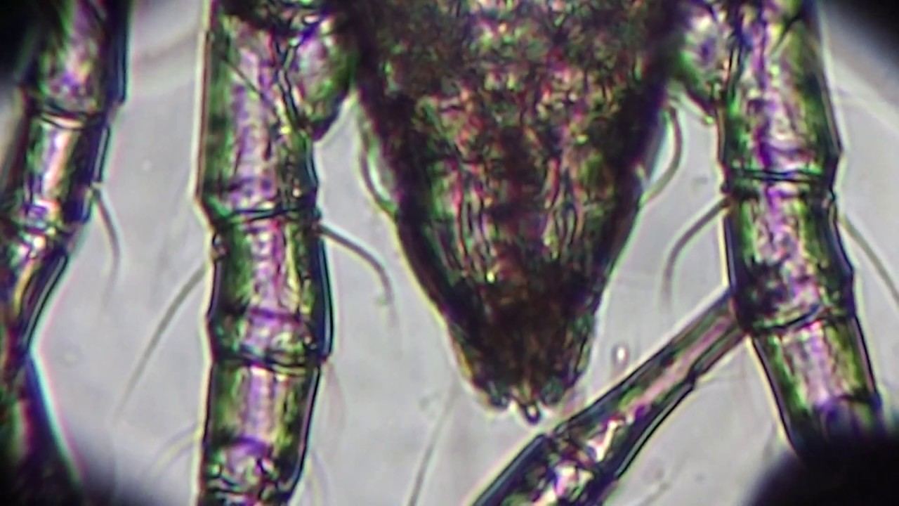 Flour Mites Acarus siro Under Microscope X 200 Big Monster Mites! YouTube