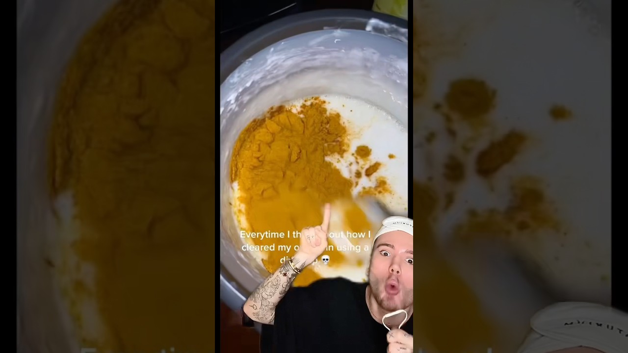 CRAZY DIY ACNE SOAP!😱 (follow for more!💗) 