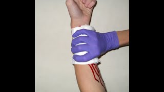 Bleeding and Shock (Emergency Care 13th edition, Limmer)