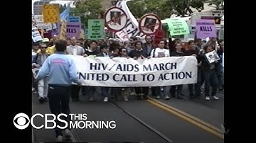 Reflecting on the AIDS epidemic on the 40th anniversary of the first reported cases