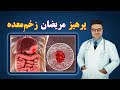 پرهیز مریضانی که زخم معده دارند داکتر قیس نیکزاد 