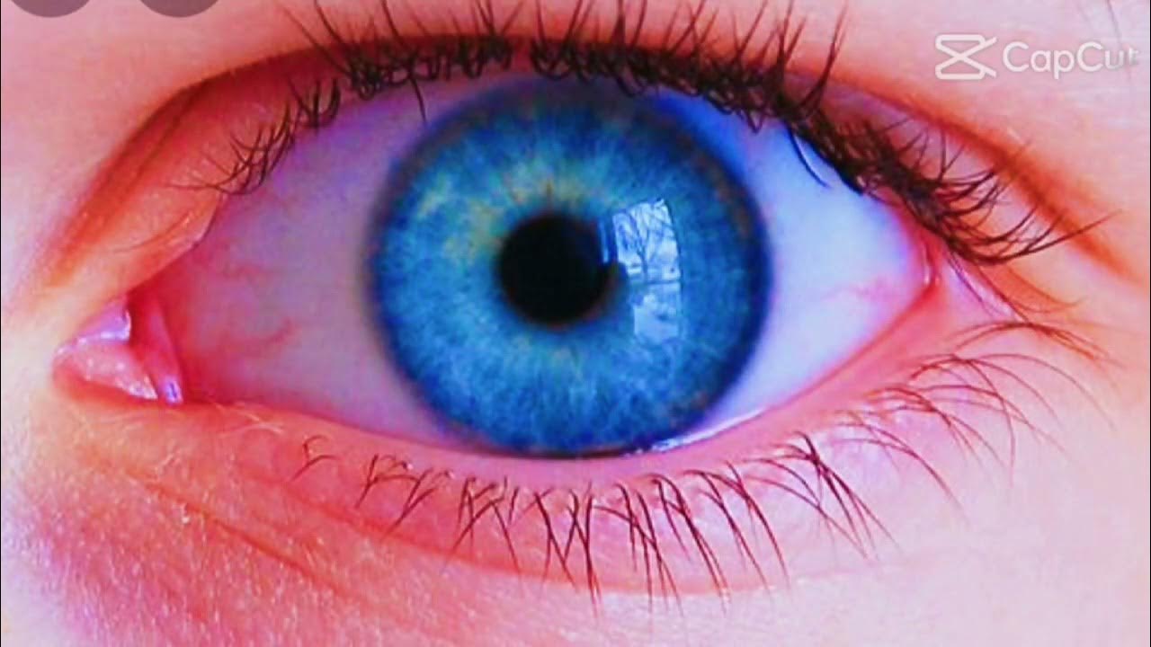 Белок глаза голубого цвета. Белок глаза с голубым оттенком. Почему белок глаза голубой. Синий цвет глаз редкий. Почему белок глаза голубой.