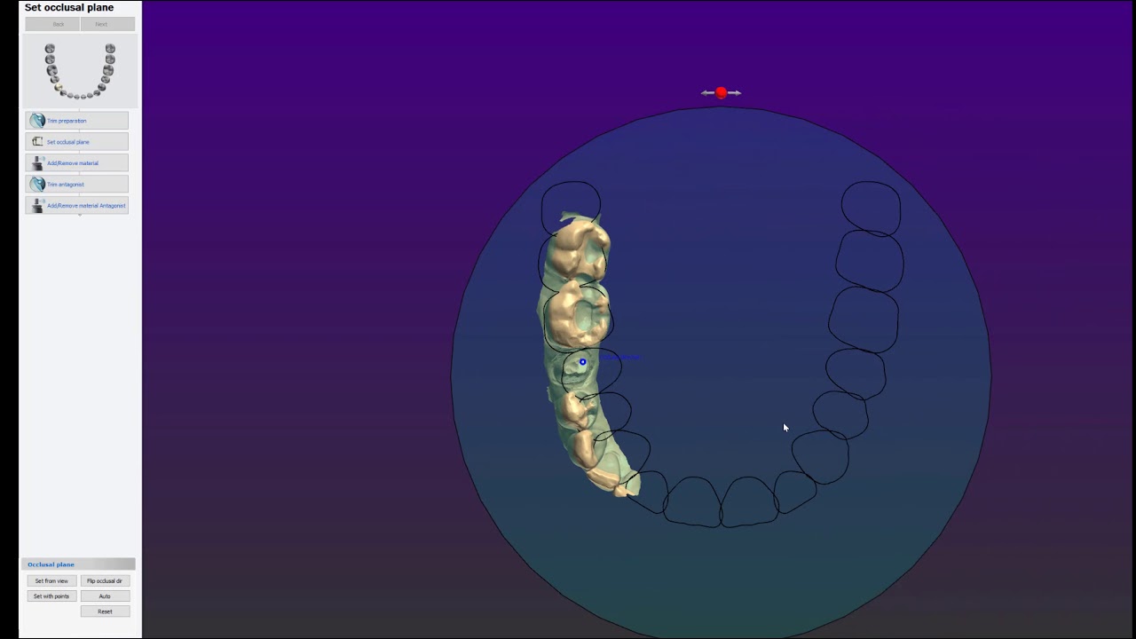 Model Build 3shape 3Shape Occlusal Plane Model Builder Tut - YouTube