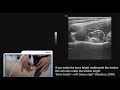 Anterior hip   2 min series mskus