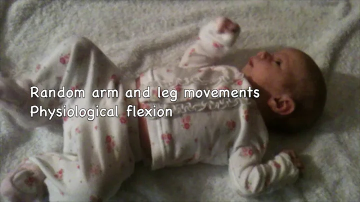 AIMS Evaluation 0 to 3 Months Education and Practice Case 5 Supine Lying