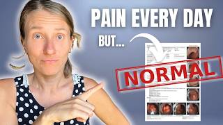 Stomach Pain Despite Normal Endoscopy? Here's What Your Doctor Missed