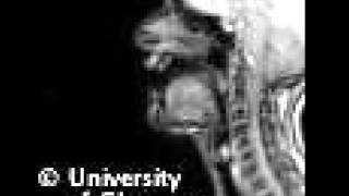 MRI voiceless dental click