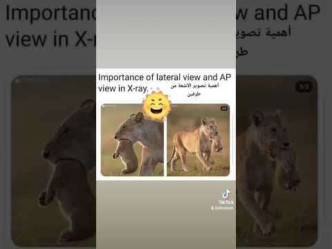رح تفهم غلط إذا عملت تصوير أشعة من جهة وحدة