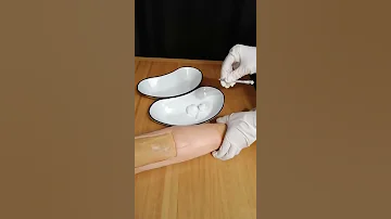 Реакция Манту