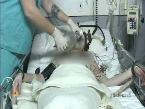 911biomed, bizzaremed, resus, resuscitation, cpr, defibs, chest, compressio...