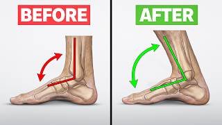 Unlocking Your Ankles Fixes Everything