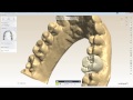 How to design digital molar and premolar tabletops in 3shape