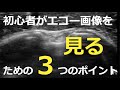 初心者がエコー画像を見るための3つのポイント