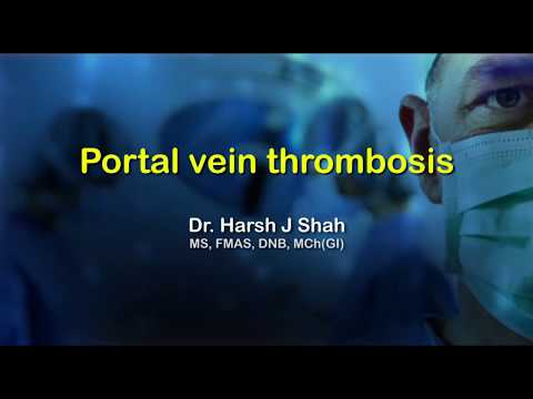 Portal vein thrombosis