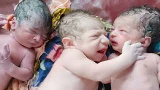 Triplets newborn babies immediately after birth with first Cry #viral #babies