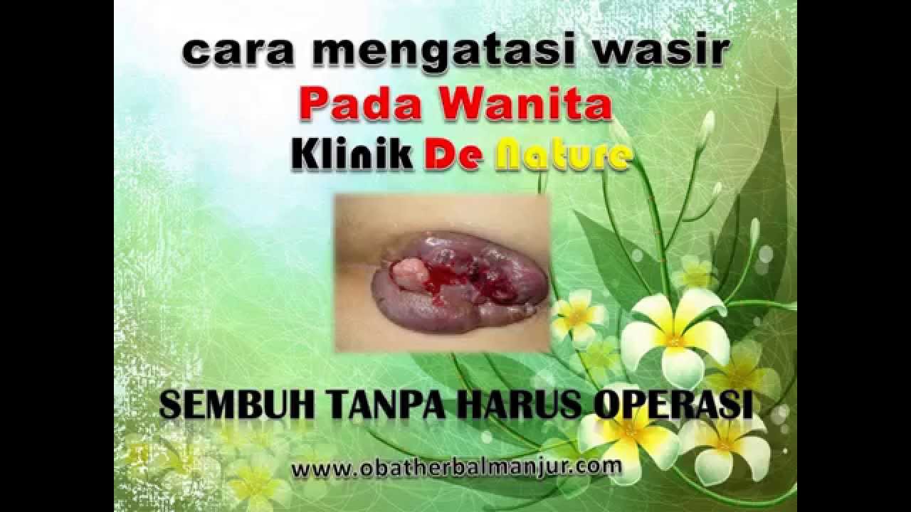 cara mengatasi wasir pada wanita