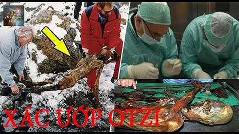 Giải Phẫu Xác Ướp 5300 Tuổi Phát Hiện Đầy Bất Ngờ Và Lời Nguyền Kinh Hoàng