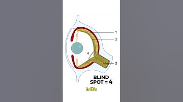 De ontbrekende vlek in jouw visie 👁️