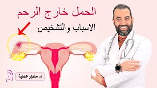 الحمل خارج الرحم أسبابه وأهمية التشخيص المبكر  د.مظهر عطية أحمد