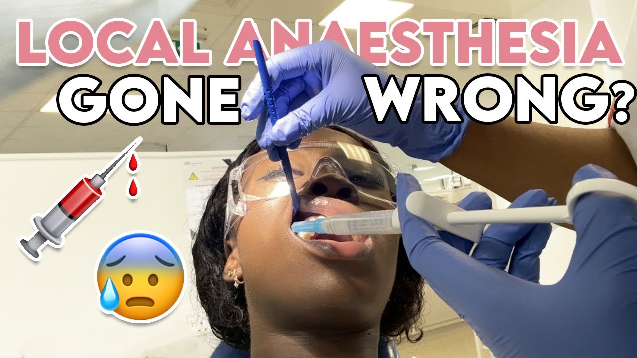 📚 DAY IN THE LIFE OF DENTAL STUDENT studying in London injections