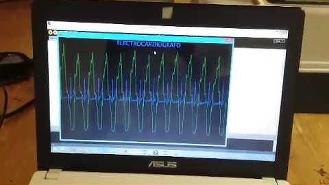 ECG con arduino - Proyecto de Clase