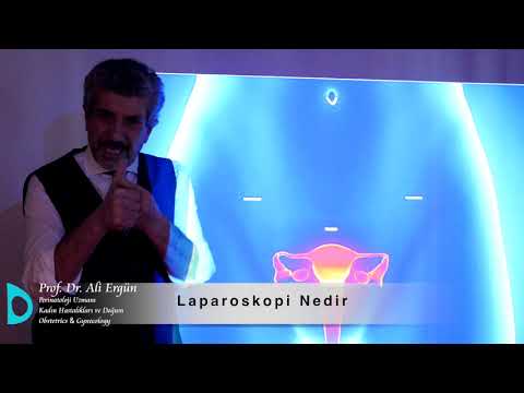 Laparoskopi Nedir? Laparoskopi nasıl yapılır?