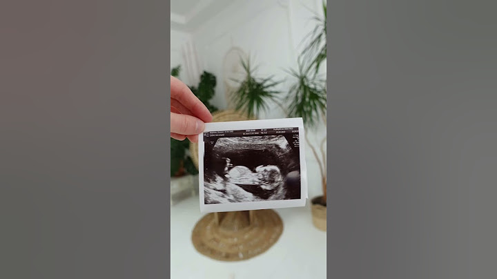 Throwback to our pregnancy announcement!