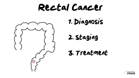 New Rectal Cancer Diagnosis - What to Expect