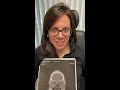 Septoplasty/Endoscopic Sinus Surgery 24 hours ago-September 2020