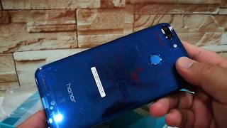 Honor 9 Lite Rm699 Dsery Beauty