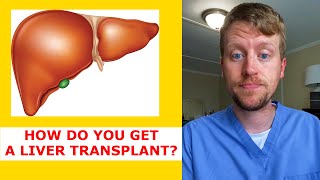 How to get a Liver Transplant (in under 60 seconds)