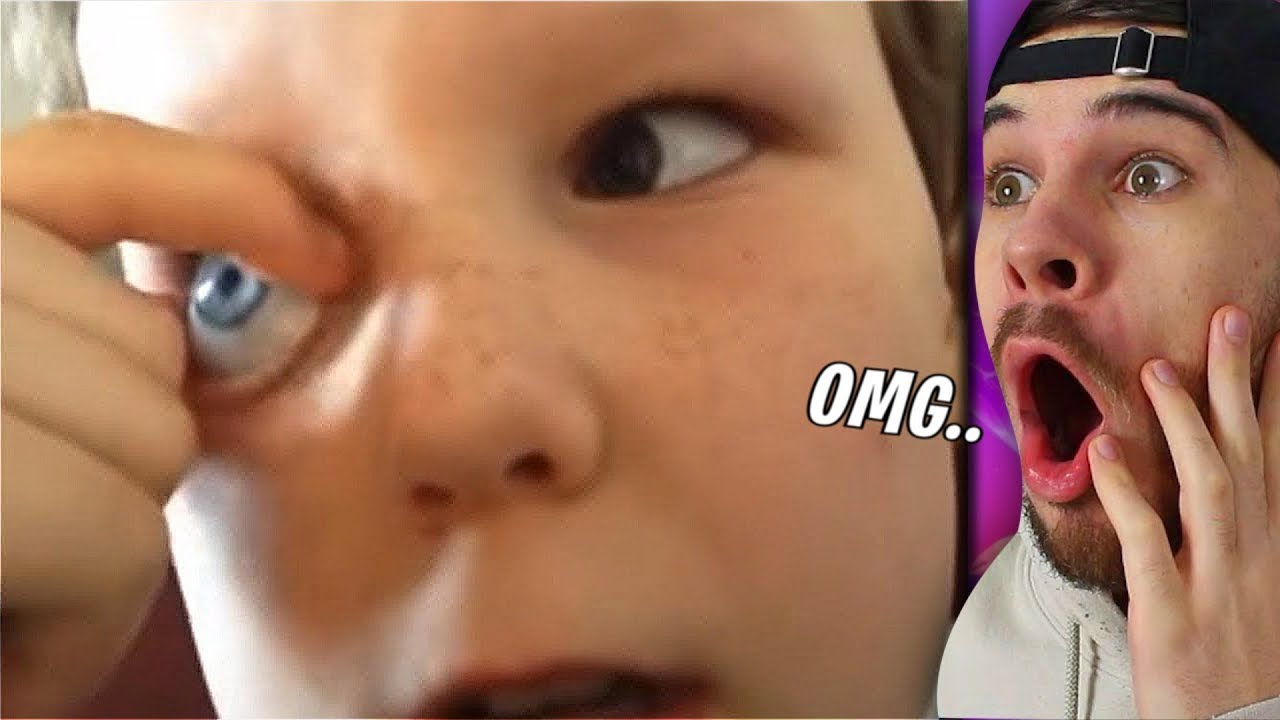 Junge 5 Kann Sein Auge Rausnehmen Youtube