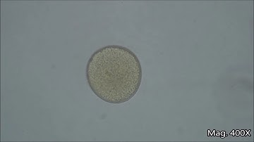 Pollen in Honey Under the Microscope