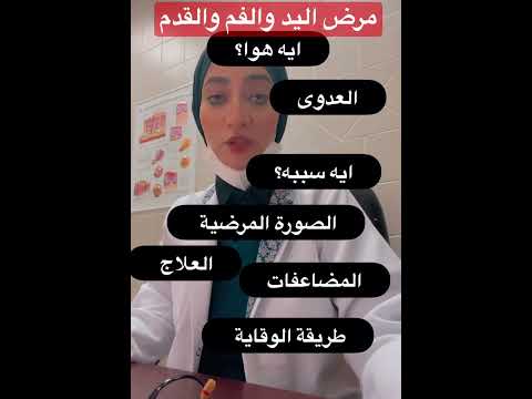 مرض اليد والفم والقدم