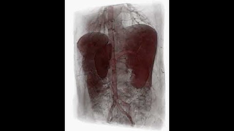 Volume Rendered MRI