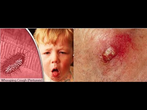 Infections of Skin Eye and the Respiratory System