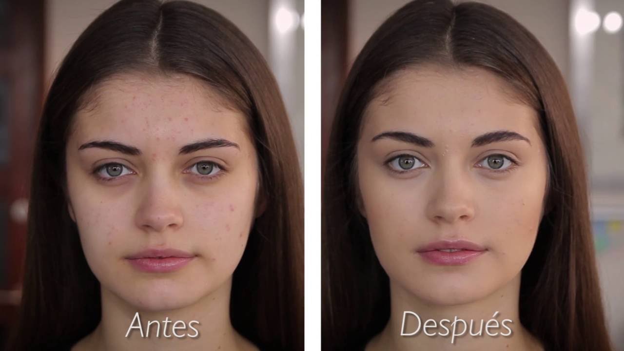 Cuidados y maquillaje para pieles con Acné y Rosácea - YouTube