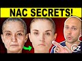 Untold secrets of nac  nacetyl cysteine