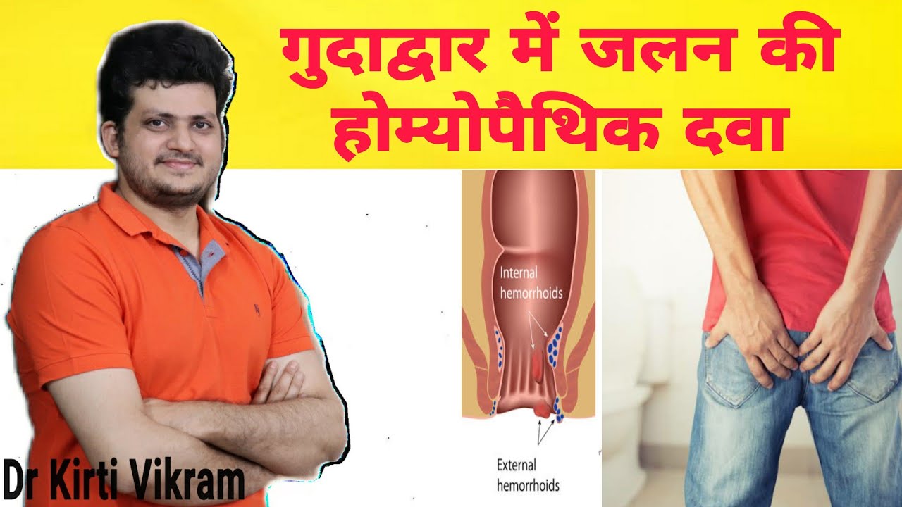 Homeopathic medicine for rectum burning ? गुदाद्वार में जलन की