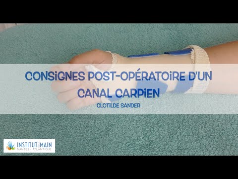 Vidéo: Comment récupérer après une chirurgie de libération du canal carpien : 10 étapes