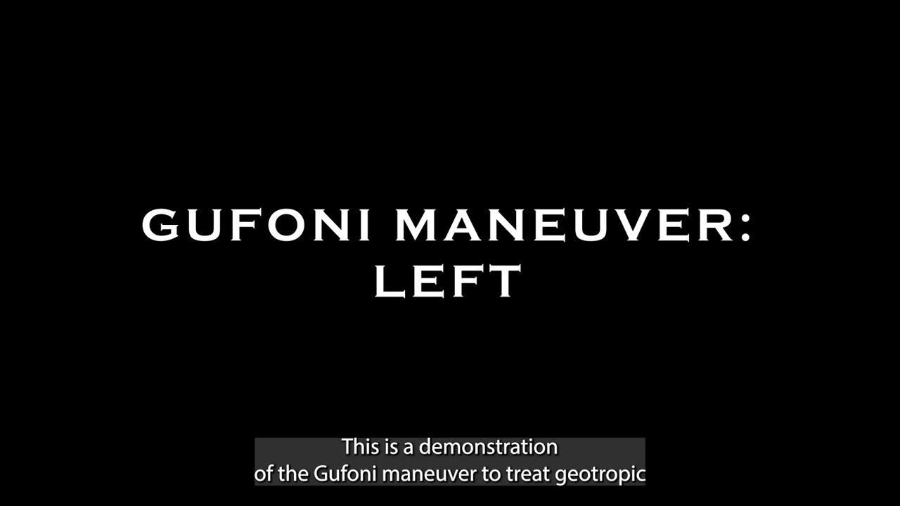 Gufoni Left for Treating Geotropic Left Lateral (Horizontal) Semicircular Canal BPPV