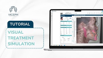 HOW TO USE VICEPH | VISUAL TREATMENT SIMULATION
