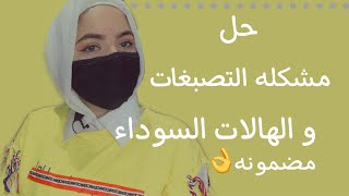 حل مشكله التصبغات و الهالات السوداء نهاائيي|salma yasser