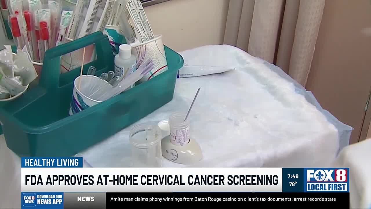 Dr. Griggs: FDA approves at-home cervical cancer screening