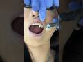 Ref:palzONSboxk Dentist reveals the secrets to viral vampire teeth!   
