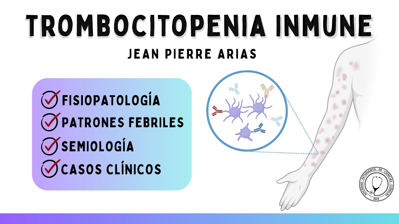 TROMBOCITOPENIA INMUNE / CLÍNICA MÉDICA