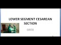 Obstetrics 693 a Lower Segment Cesarean section csection caesarean incision LSCS Pfannenstiel