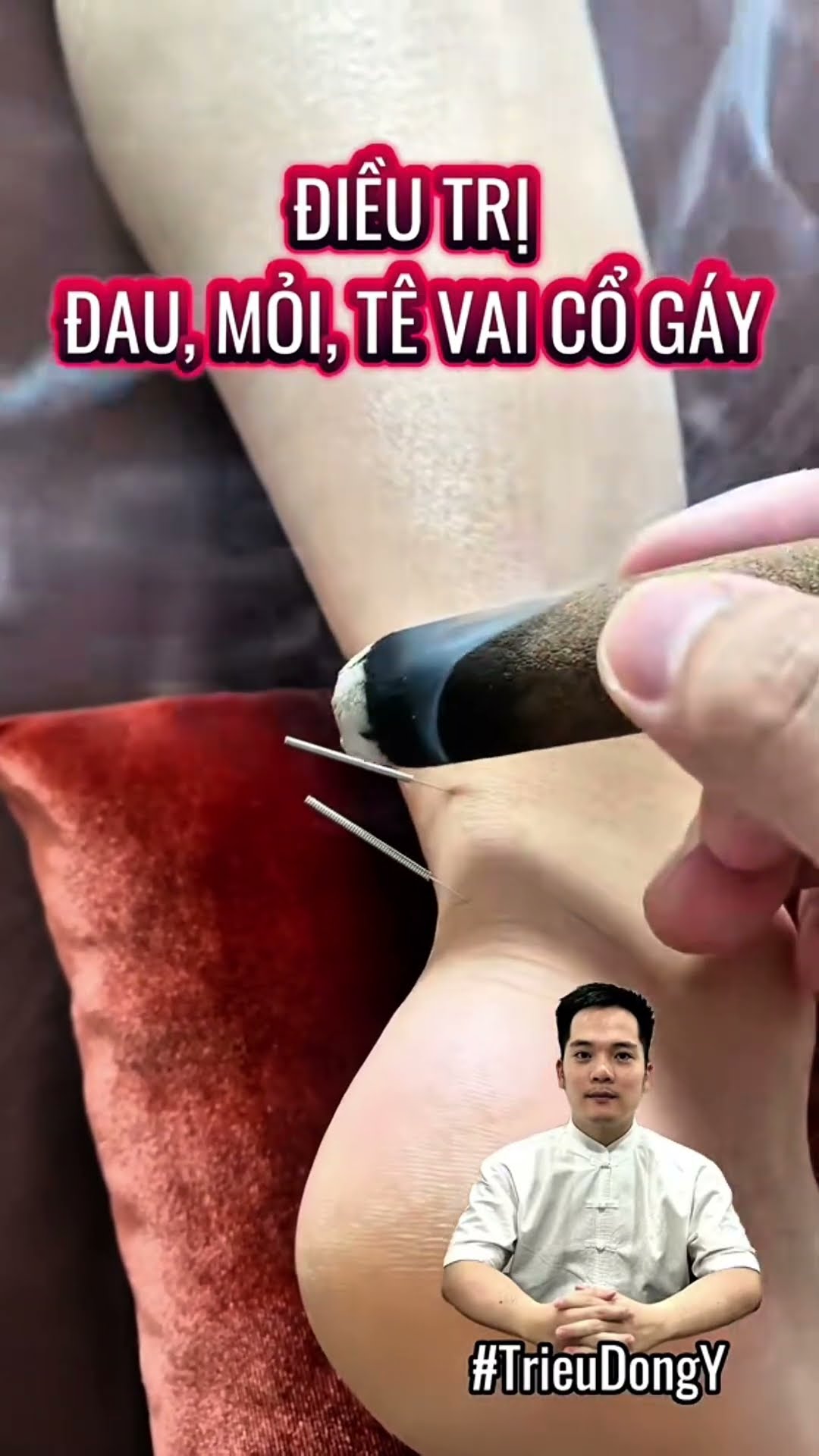 Địa chỉ uy tín điều trị đau, cứng và tê vùng vai gáy