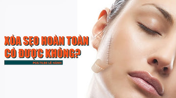 Sẹo lồi, sẹo lõm, sẹo trắng, sẹo thâm... có XÓA HẾT được không?