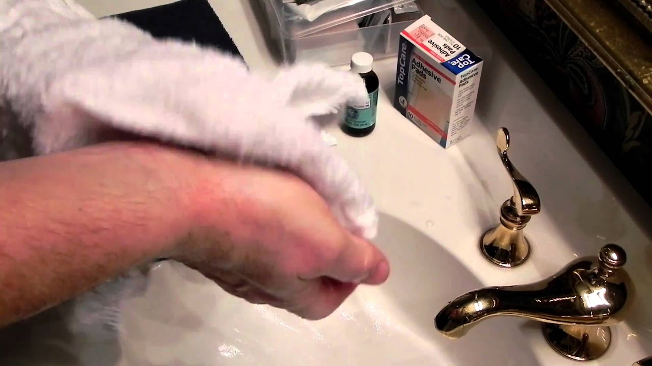 post surgery dressing.MOV YouTube